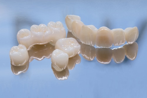 Crowns & Bridges in Wilkes-Barre, PA Mint Mini Dental Implants