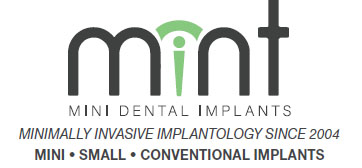 Mint Mini Dental Implants – John Coolican, DMD