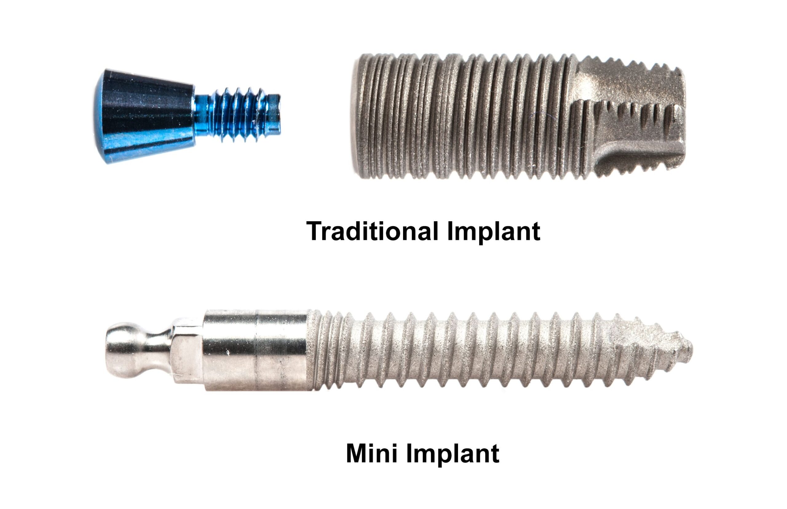 Diente Perdido en Wilkes-Barre, PA | Mini Implantes Dentales Mint