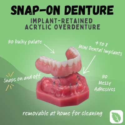 Snap-In Dentures in Stroudsburg, PA | Mint Mini Dental Implants