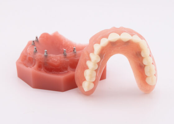 Clip On Dentures in Wilkes-Barre, PA | Book a Free Consultation!