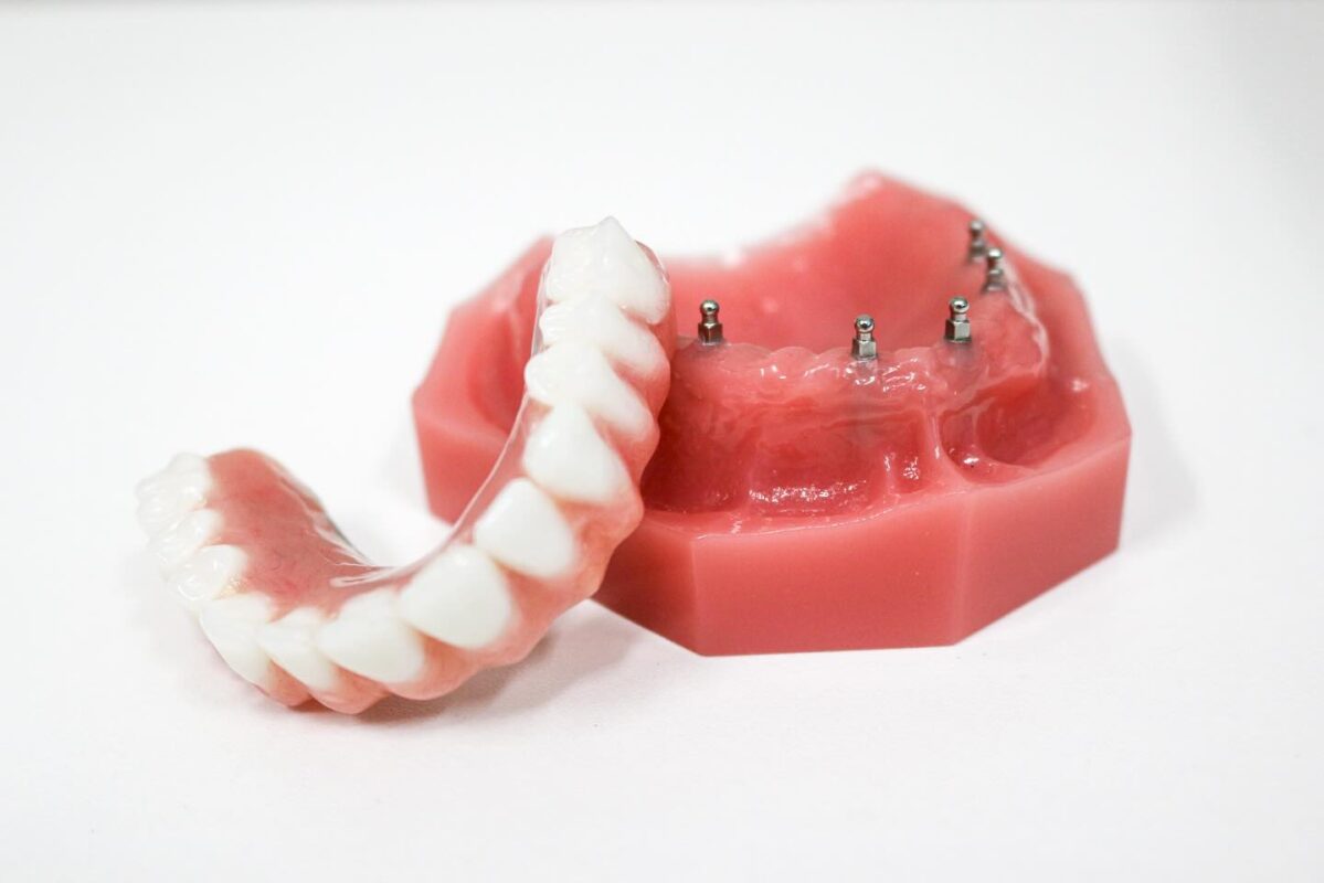 All-on-4 Alternatives in Allentown, PA | Book a Free Consultation