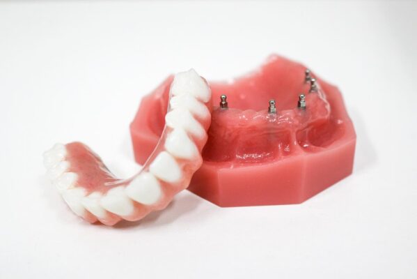 All-on-4 Alternatives in Allentown, PA | Book a Free Consultation