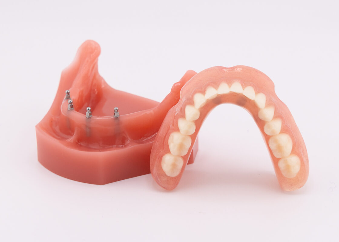Denture Stabilization in Stroudsburg, PA | Book a Free Consultation